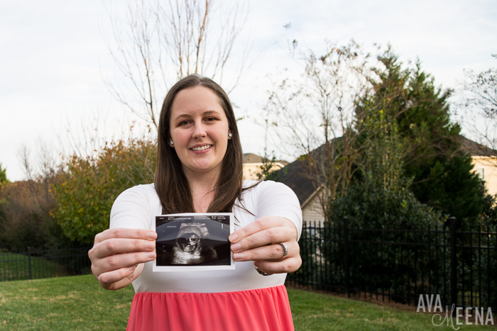 Posing with my ultrasound. | My Lupus Pregnancy: The First Trimester.