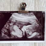 The First Trimester With My Second Baby. The First Trimester With My Second Baby.