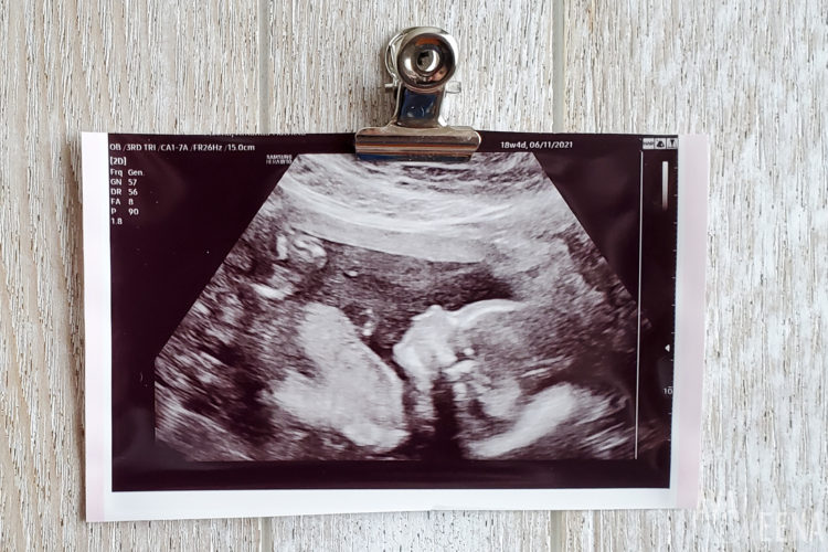 My First Trimester With My Second Baby. │ Ava of My Meena Life