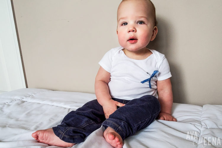 baby with caffey disease